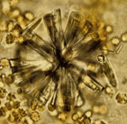 amorphous phosphate crystals in urine