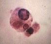 macrophages