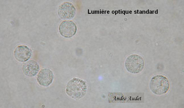 Leucocytes type 