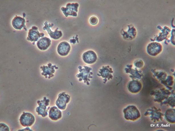 Leucocytes type 