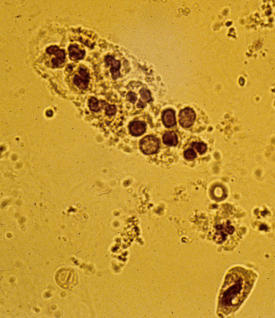 Копрограмма микроскопия лейкоциты